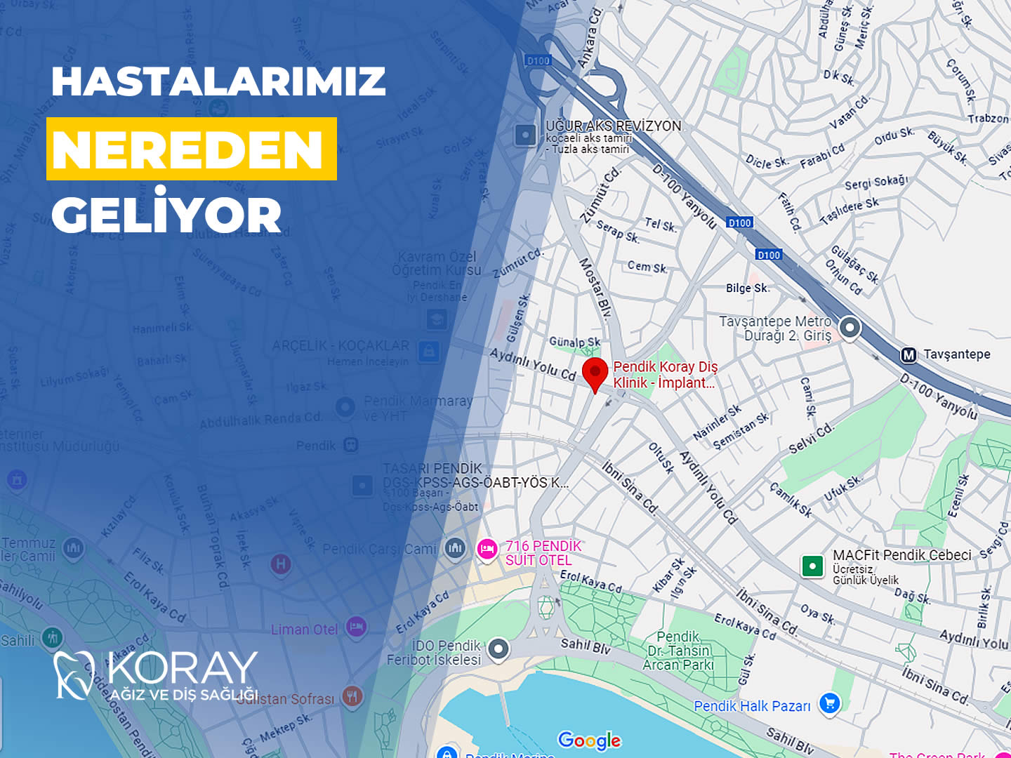 Koray Diş Klinikʼe Hastalarımız Nereden Geliyor?