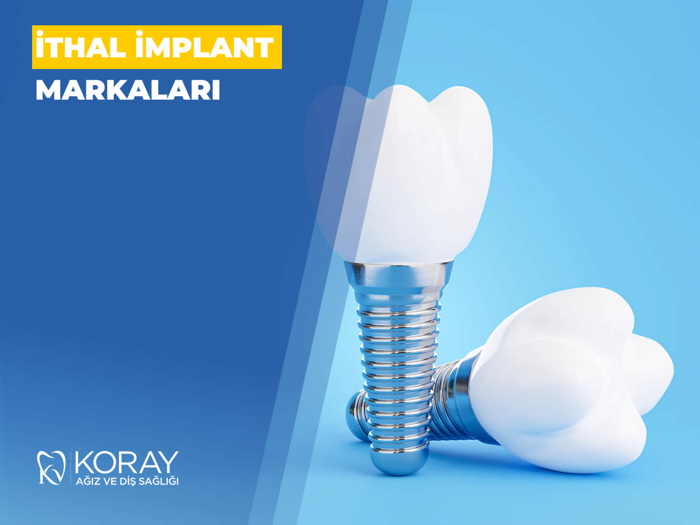 İthal İmplant Markaları