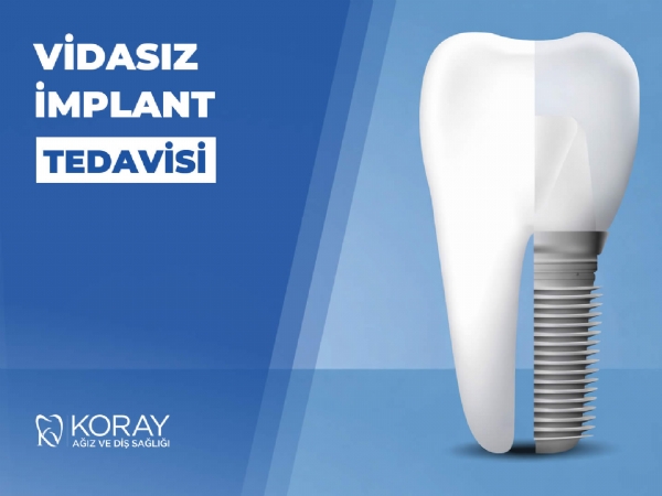 Vidasız İmplant