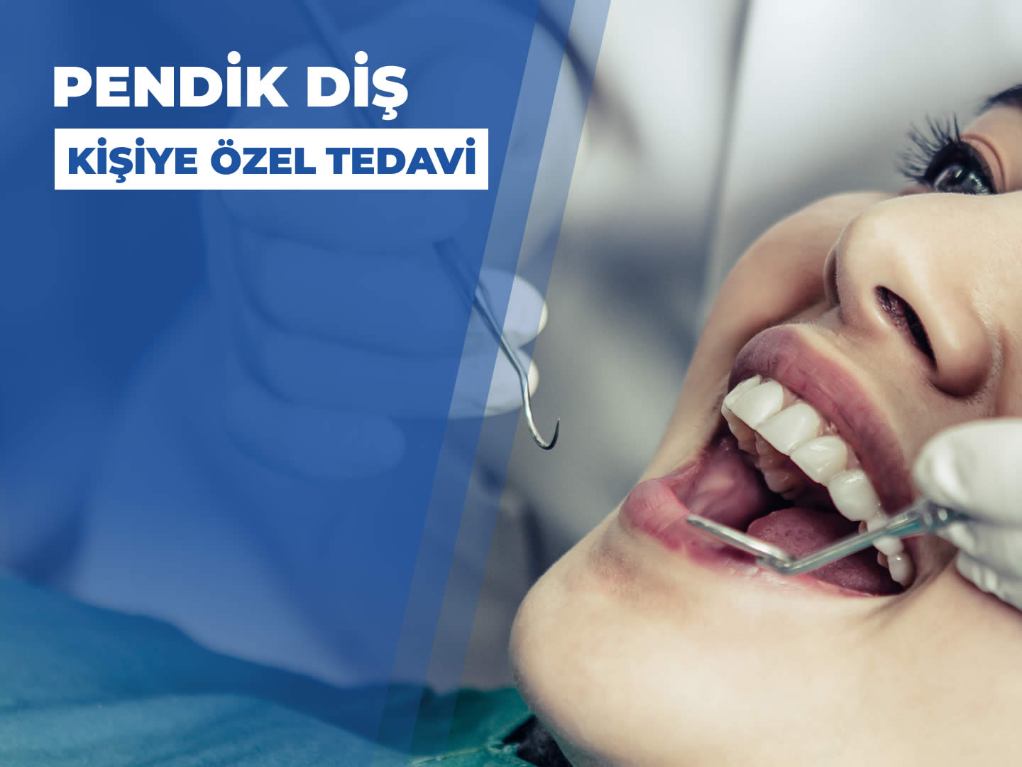 Pendik Diş Klinik - Kişiye Özel Estetik Diş Tedavileri