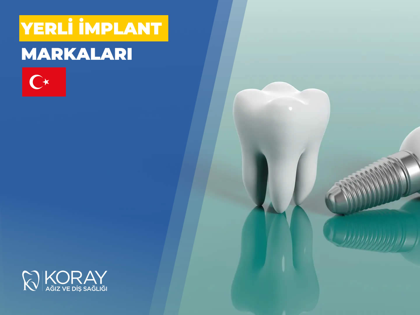 Türk İmplant Markaları